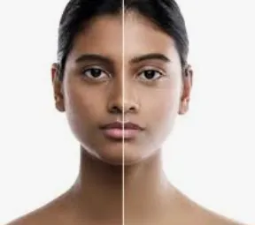 Skin Brightening Treatment