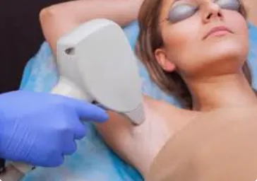 Laser Hair Reduction