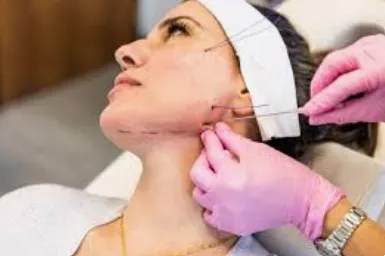 Non-Surgical Face Lift