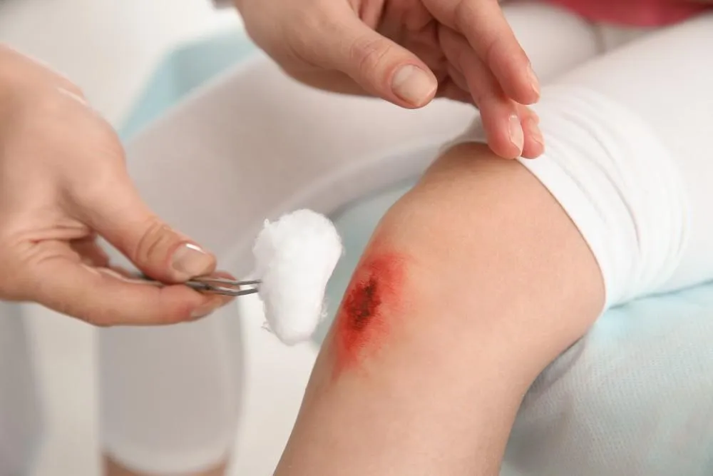 Wound Care